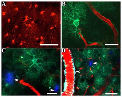 In Vivo Two Photon Imaging of Astrocytic Structure and Function in Alzheimer’s Disease